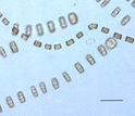 The chain-forming diatom Thalassiosira, seen under a microscope